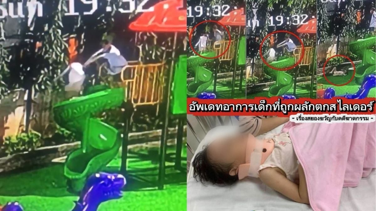 Hanoi girl hospitalised with skull and eye socket fractures after playground fall